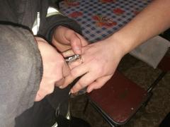 Хойникские спасатели сняли кольцо с пальца жительницы города.